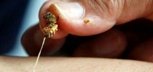 к чему снится укус пчелы в спину